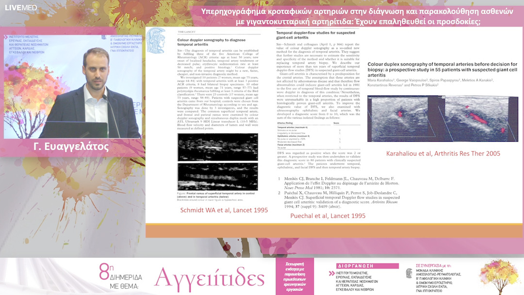 39 Γ. Ευαγγελάτος - Μπορούμε να προβλέψουμε την πορεία των ANCA-αγγειιτίδων με νεφρική προσβολή; Α. Χαλκιά Υπερηχογράφημα κροταφικών αρτηριών στην διάγνωση και παρακολούθηση ασθενών με γιγαντοκυτταρική αρτηρίτιδα: Έχουν επαληθευθεί οι προσδοκίες;