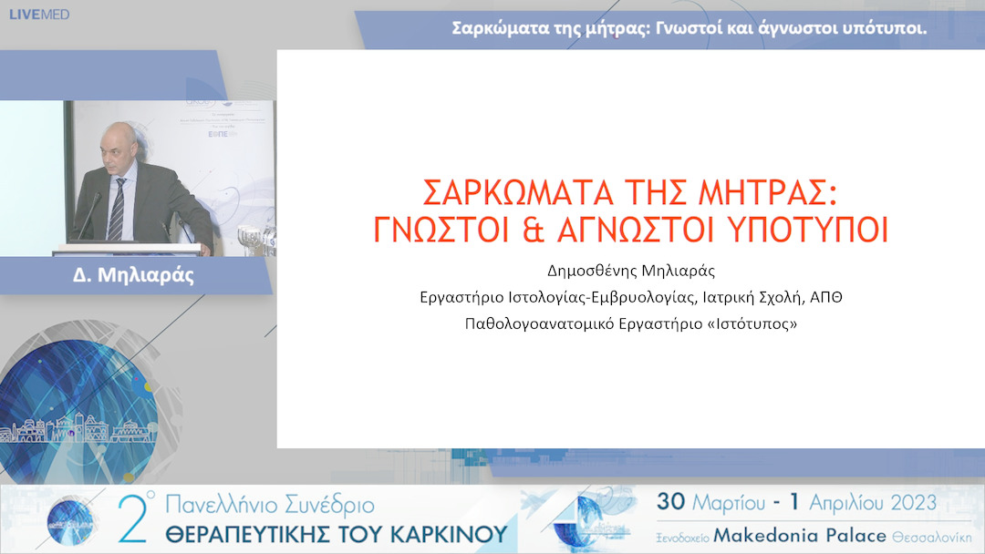 53  Δ. Μηλιαράς - Σαρκώματα της μήτρας: Γνωστοί και άγνωστοι υπότυποι