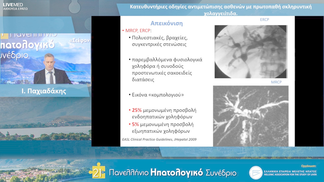 45 Ι. Παχιαδάκης - Κατευθυντήριες οδηγίες αντιμετώπισης ασθενών με πρωτοπαθή σκληρυντική χολαγγειίτιδα.