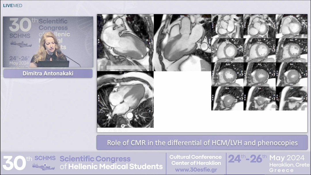 42 Dimitra Antonakaki - Role of CMR in the differential of HCM/LVH and phenocopies