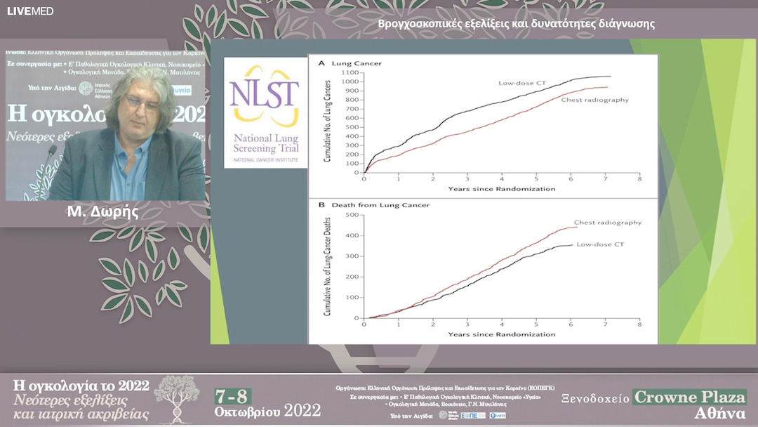 33 Μ. Δωρής - Βρογχοσκοπικές εξελίξεις και δυνατότητες διάγνωσης 