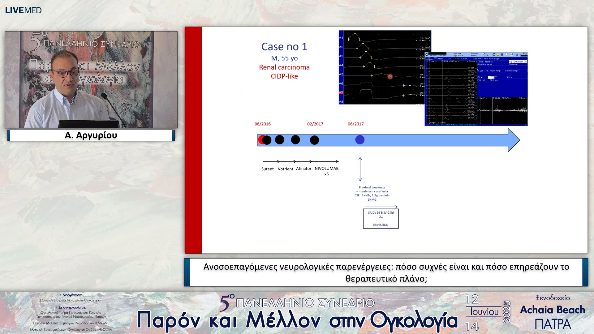 17 Α. Αργυρίου - Ανοσοεπαγόμενες νευρολογικές παρενέργειες: πόσο συχνές είναι και πόσο επηρεάζουν το θεραπευτικό πλάνο;
