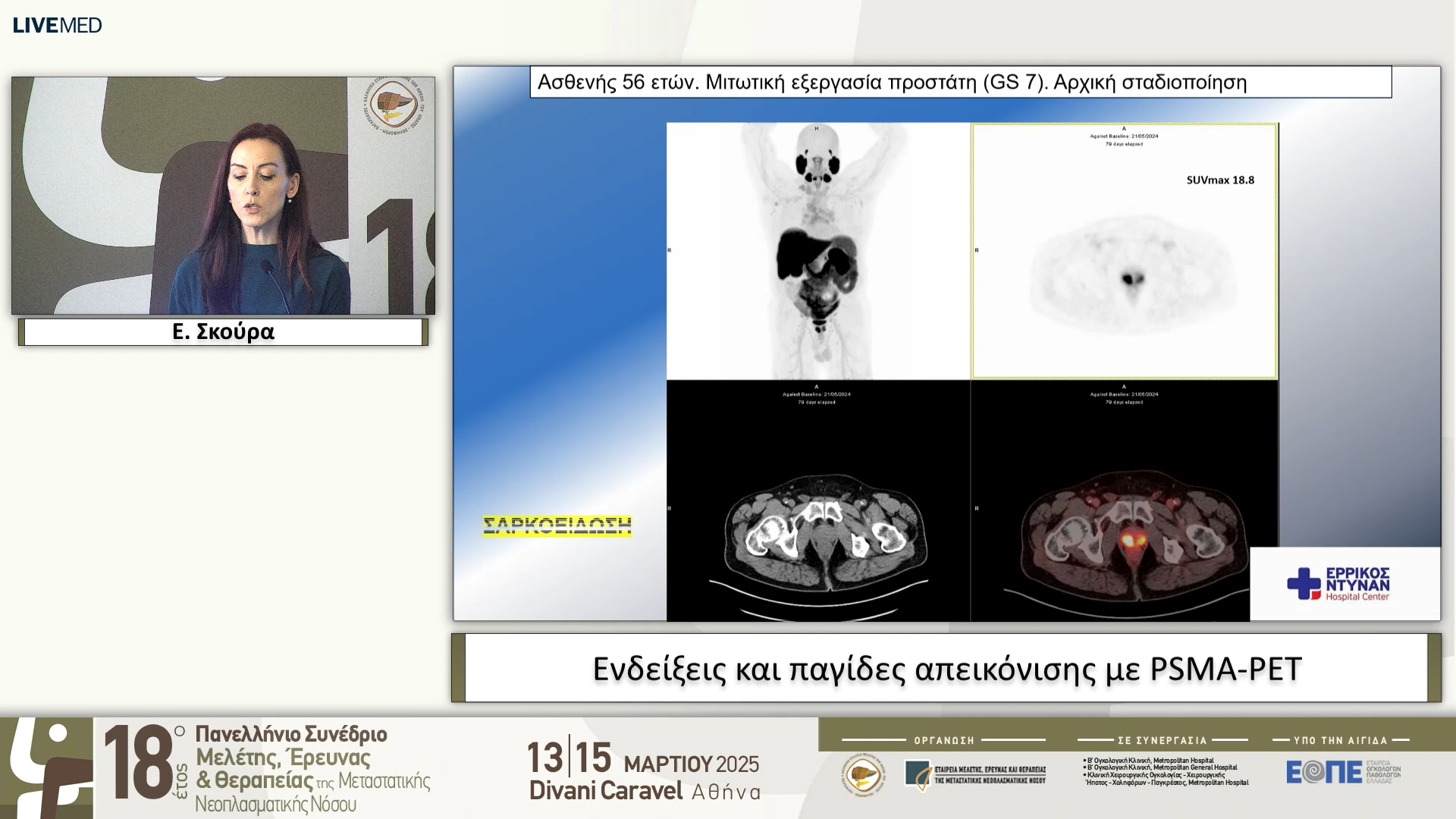 28 Ε. Σκούρα - Ενδείξεις και παγίδες απεικόνισης με PSMA-PET