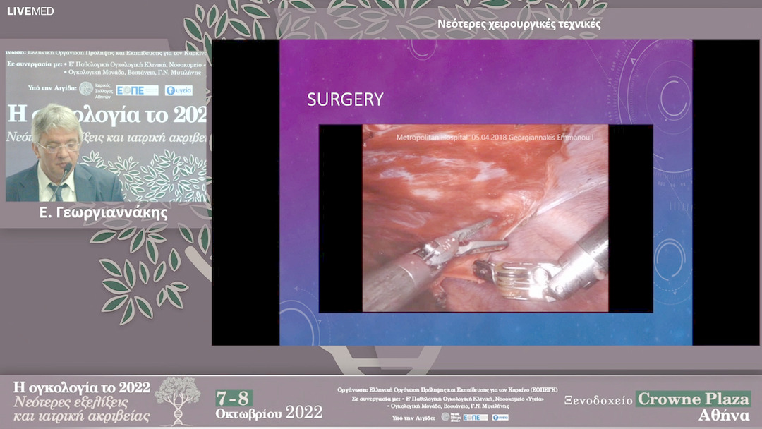 34 Ε. Γεωργιαννάκης - Νεότερες χειρουργικές τεχνικές