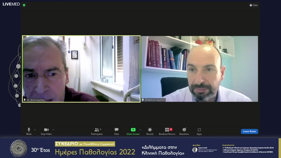 35 Ε. Καστρίτης - Εξελίξεις στη θεραπεία αμυλοείδωσης 