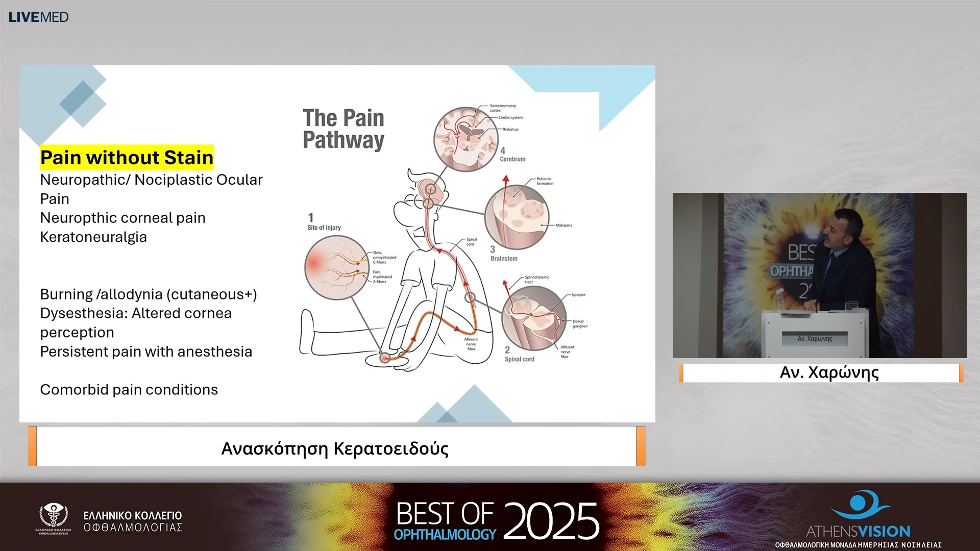 22 Αν. Χαρώνης - Aνασκόπηση Κερατοειδούς 