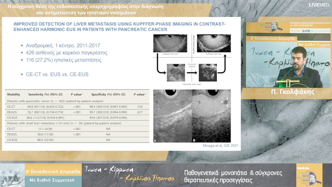 31 Π. Γκολφάκης - Η σύγχρονη θέση της ενδοσκοπικής υπερηχογραφίας στην διάγνωση και αντιμετώπιση των ηπατικών νοσημάτων