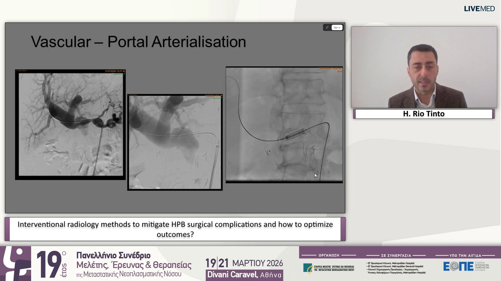 27 H. Rio Tinto - Interventional radiology methods to mitigate HPB surgical complications and how to optimize outcomes?
