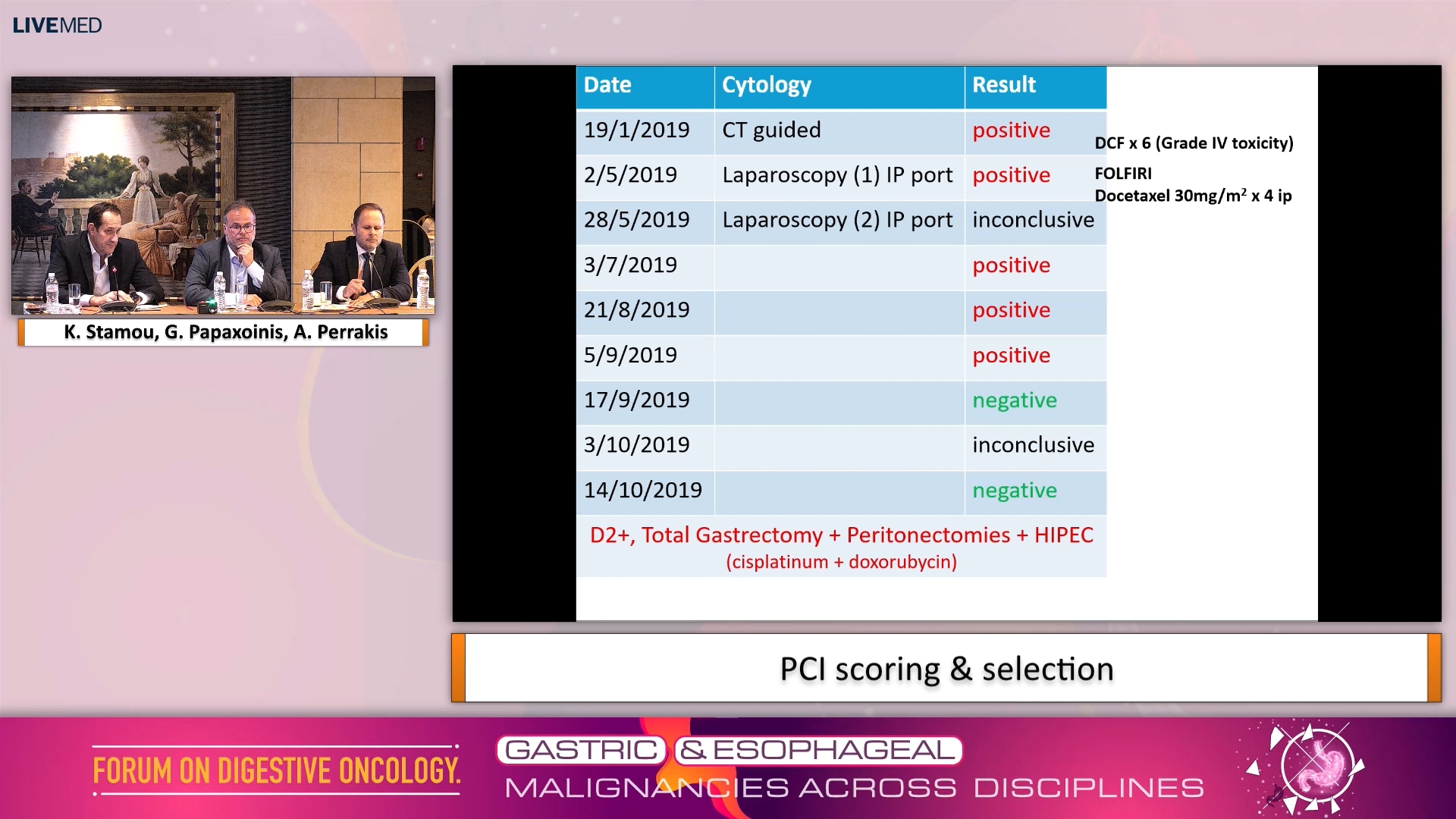 17 Case11: Gastric Cancer with Peritoneal Dissemination - HIPEC