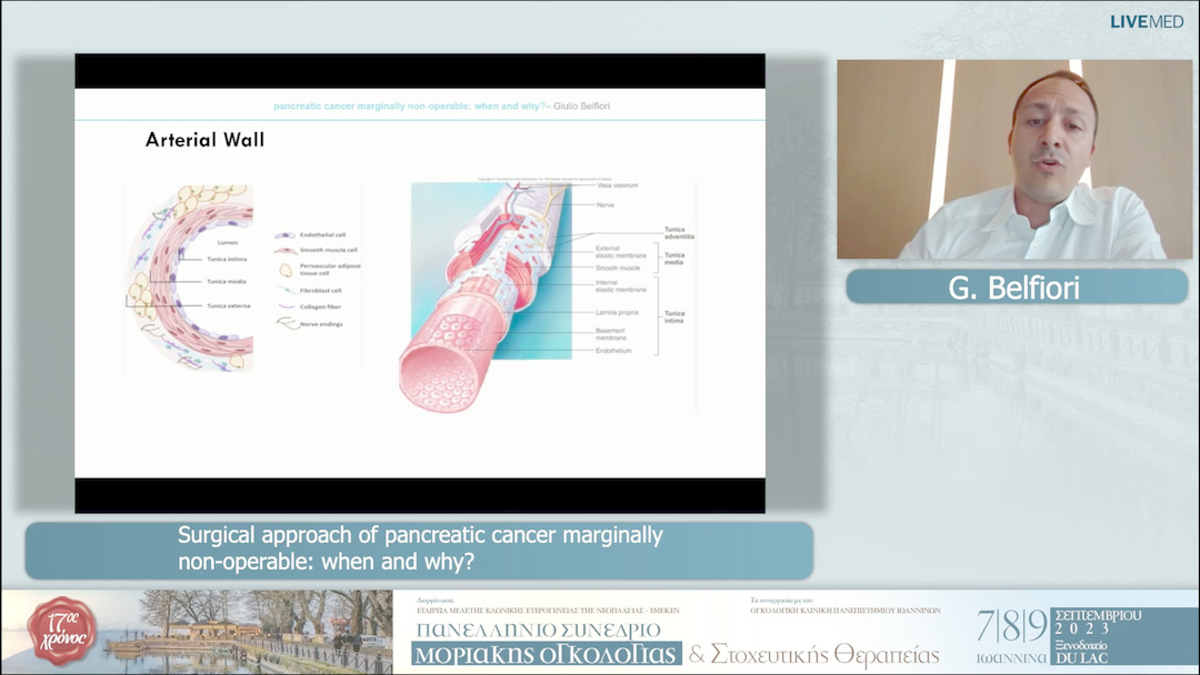 28 G. Belfiori - Surgical approach of pancreatic cancer marginally non-operable: when and why?