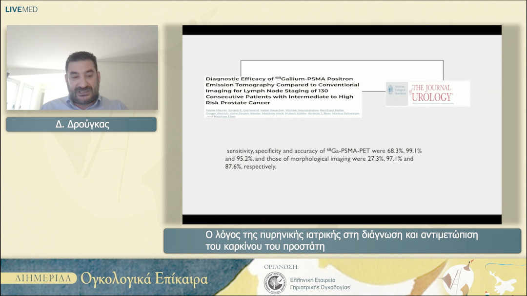 45 Δ. Δρούγκας - Ο λόγος της πυρηνικής ιατρικής στη διάγνωση και αντιμετώπιση του καρκίνου του προστάτη 