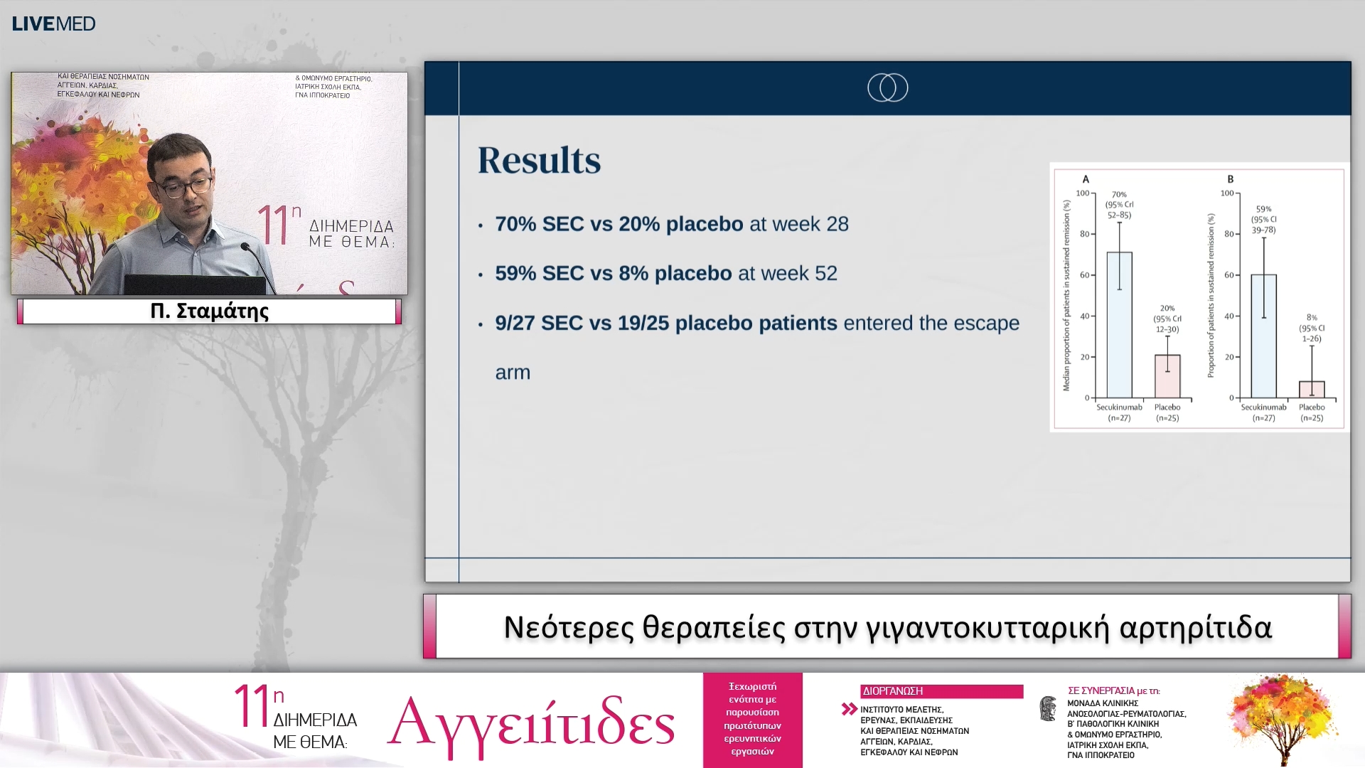 30 Π. Σταμάτης - Νεότερες θεραπείες στην γιγαντοκυτταρική αρτηρίτιδα