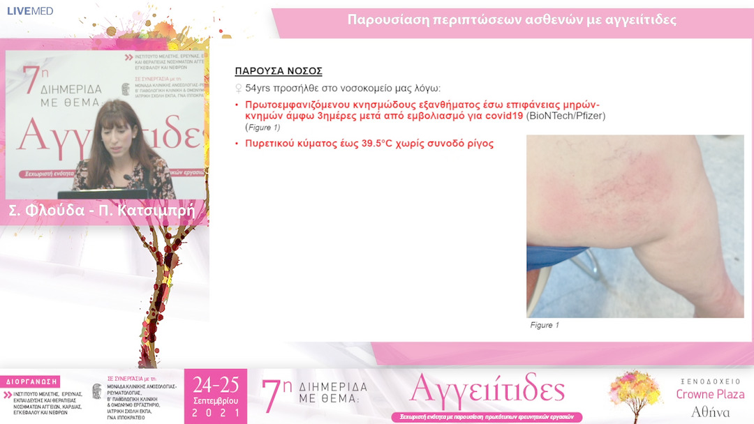 32 Σ. Φλούδα - Π. Κατσιμπρή - ΠΑΡΟΥΣΙΑΣΗ - ΣΥΖΗΤΗΣΗ ΠΕΡΙΠΤΩΣΕΩΝ ΑΣΘΕΝΩΝ ΜΕ ΑΓΓΕΙΙΤΙΔΕΣ