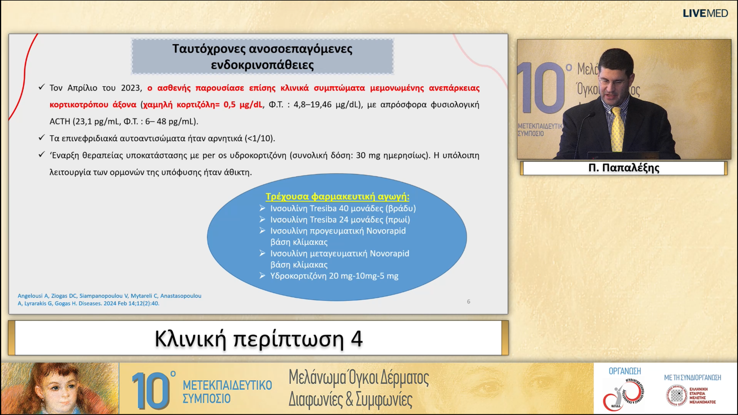 33 Π. Παπαλέξης - Κλινική περίπτωση 4