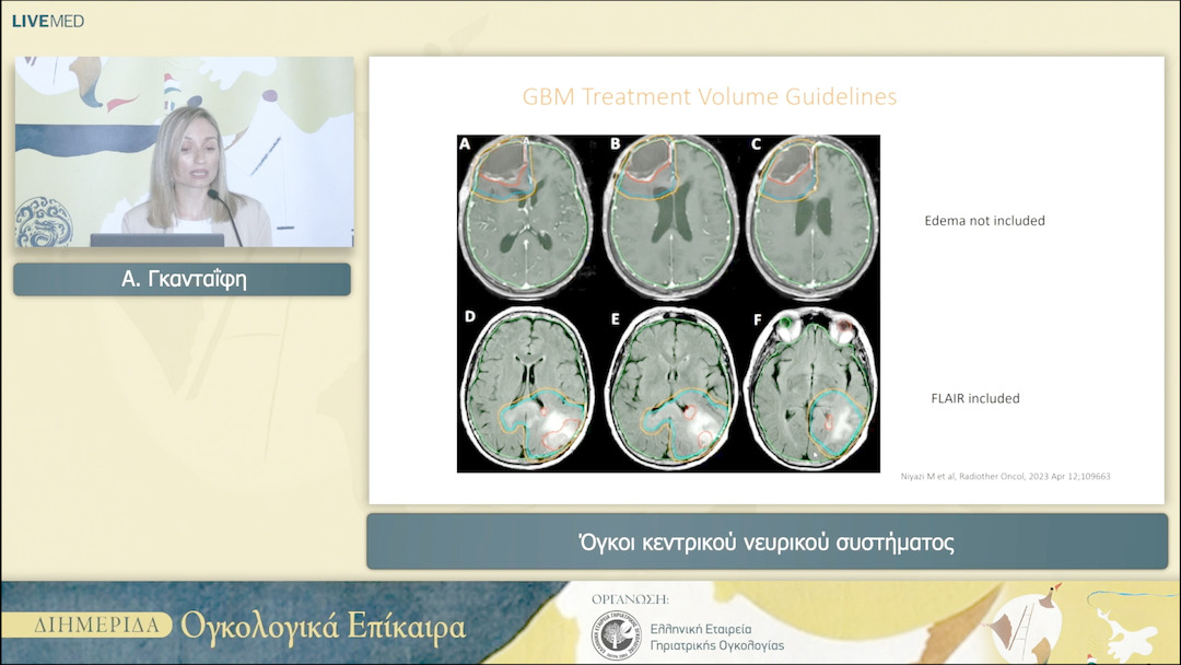 27 Α. Γκανταΐφη - Όγκοι κεντρικού νευρικού συστήματος 