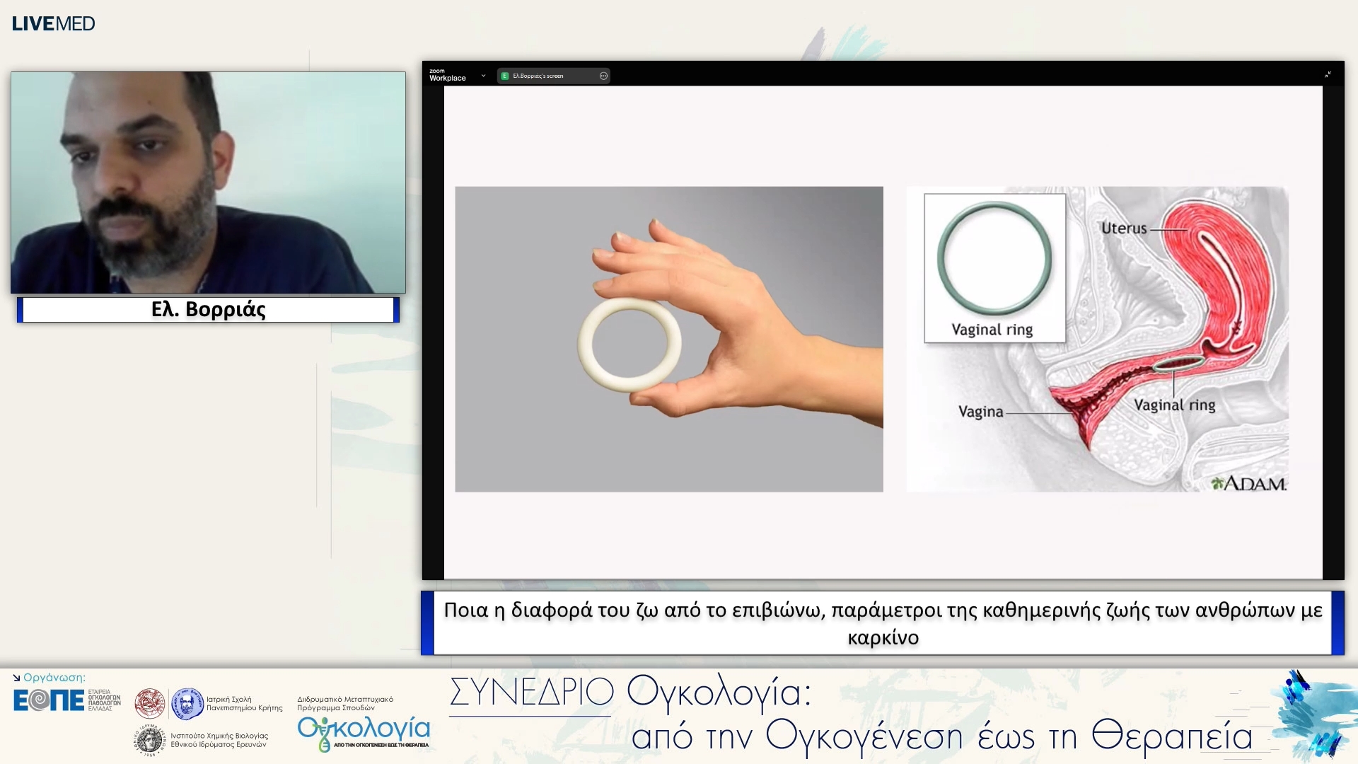 16 Ελ. Βορριάς - Ποια η διαφορά του ζω από το επιβιώνω, παράμετροι της καθημερινής ζωής των ανθρώπων με καρκίνο. 