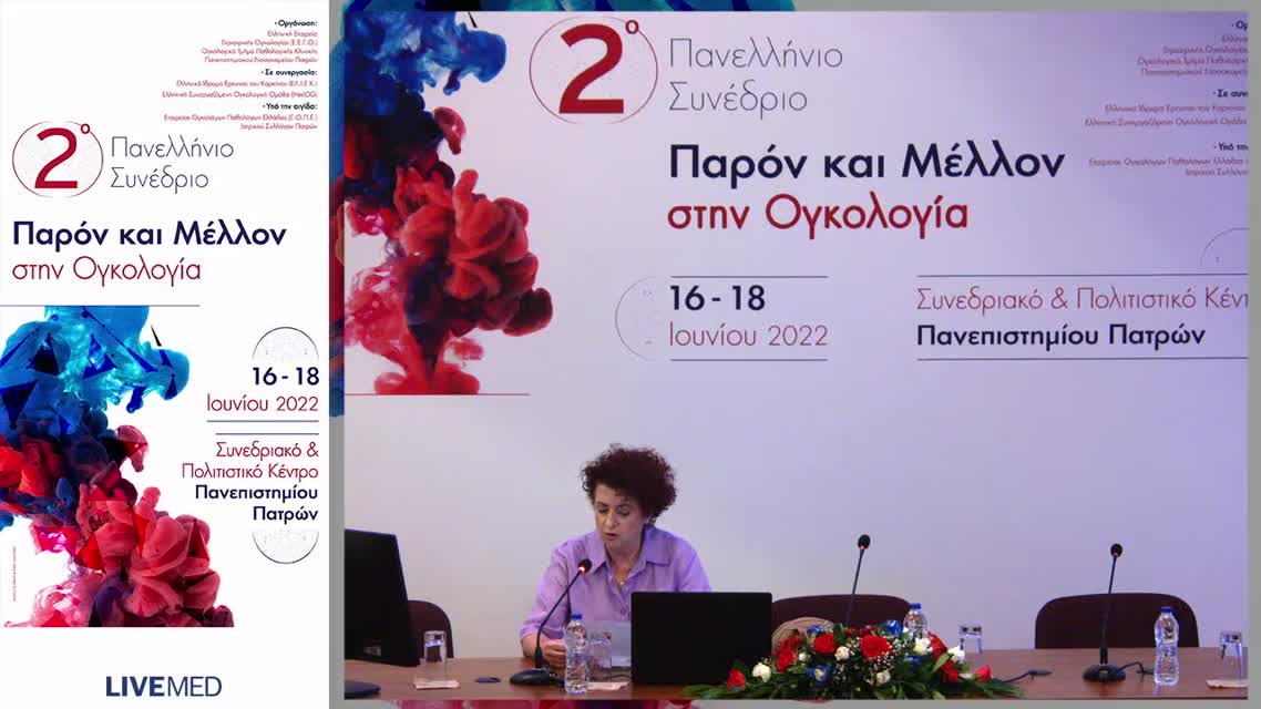 51 Π. Οικονομοπούλου - Νεότερες εξελίξεις στην αντιμετώπιση του καρκίνου του ρινοφάρυγγα και των σιελογόνων αδένων.