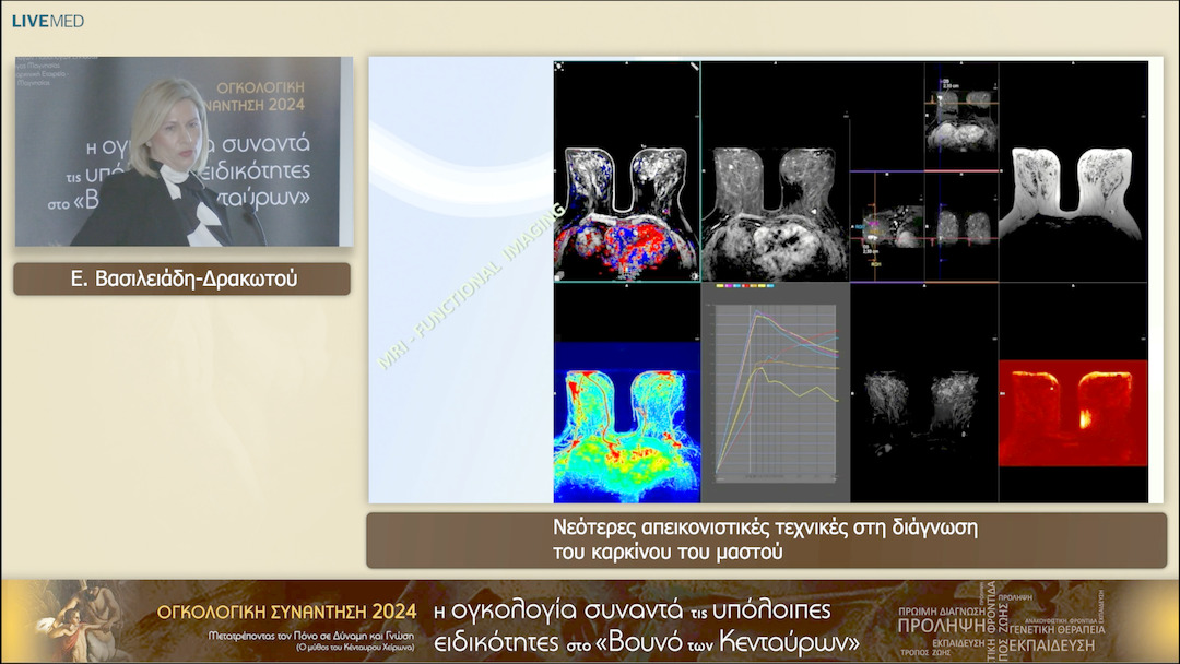 29 Ε. Βασιλειάδη-Δρακωτού - Νεότερες απεικονιστικές τεχνικές στη διάγνωση του καρκίνου του μαστού 