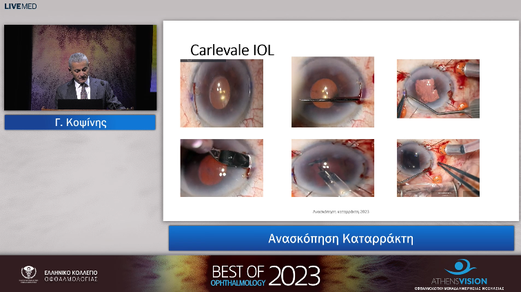 20 Γ. Κοψίνης - Ανασκόπηση Καταρράκτη 