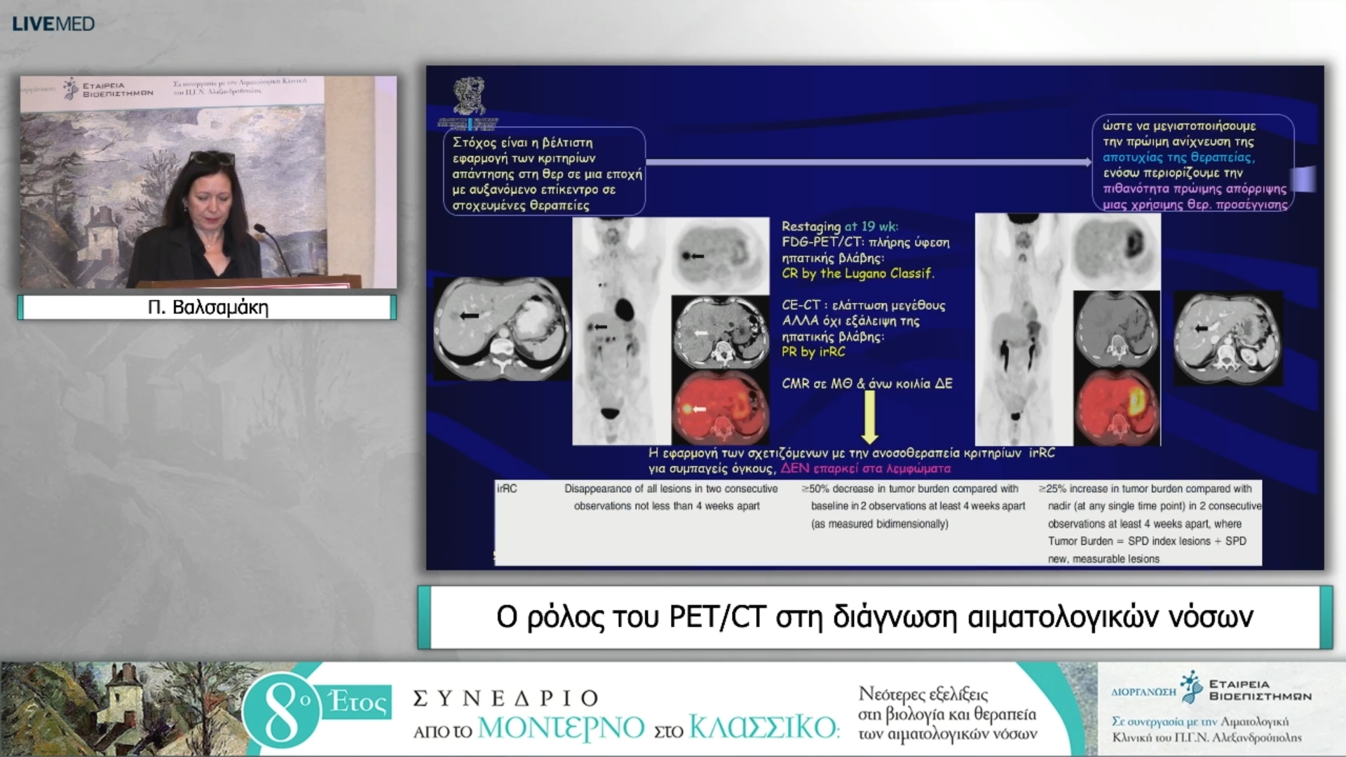 58 Π. Βαλσαμάκη - Ο ρόλος του ΡΕΤ/CT στη διάγνωση αιματολογικών νόσων