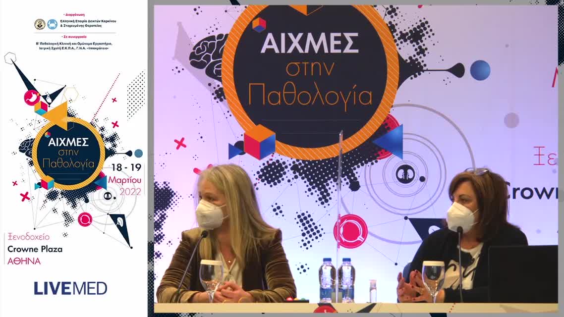 30 Θωμάς Κ. - Αντιική αγωγή σε ασθενείς με COVID19:Που βρισκόμαστε σήμερα; 