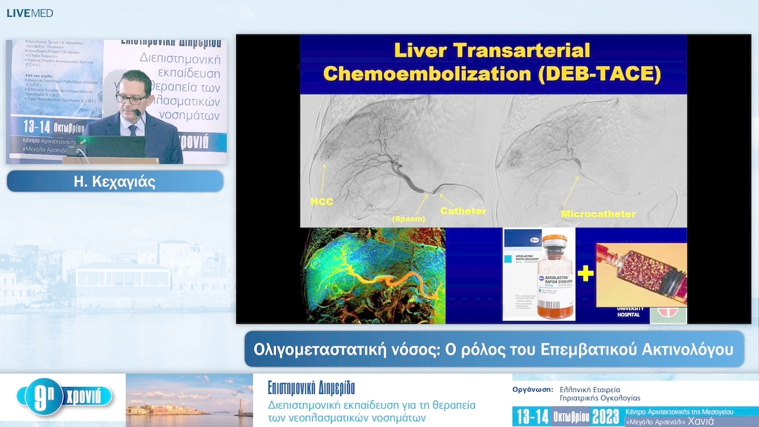 31 Η. Κεχαγιάς - Ο ρόλος του Επεμβατικού Ακτινολόγου 