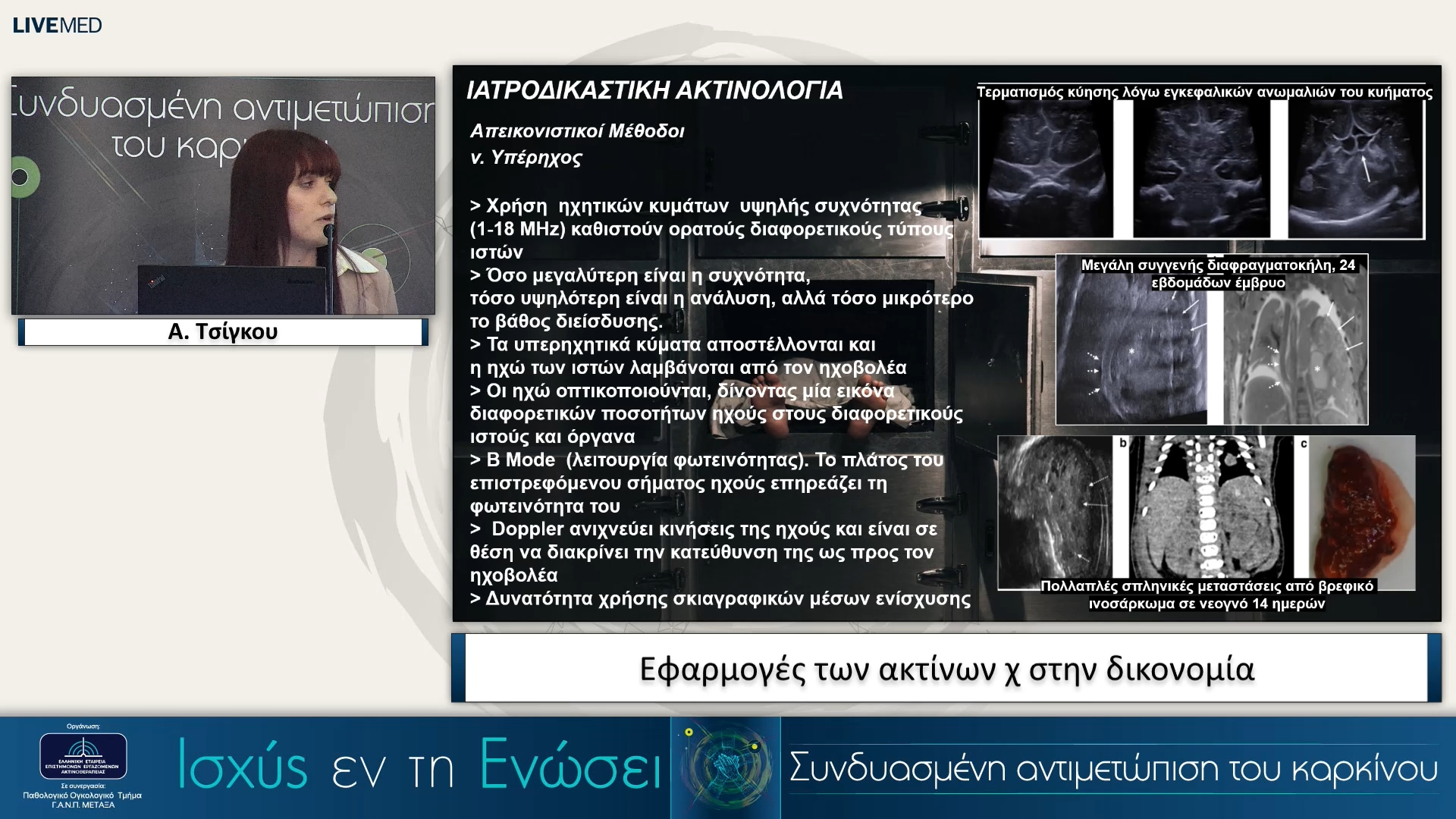 18 Α. Τσίγκου - Εφαρμογές των ακτίνων χ στην δικονομία