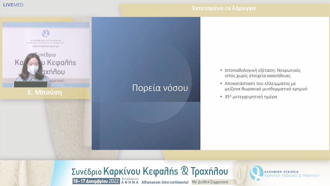 36 Ε. Μπούση - Εκτεταμένο ca λάρυγγα.