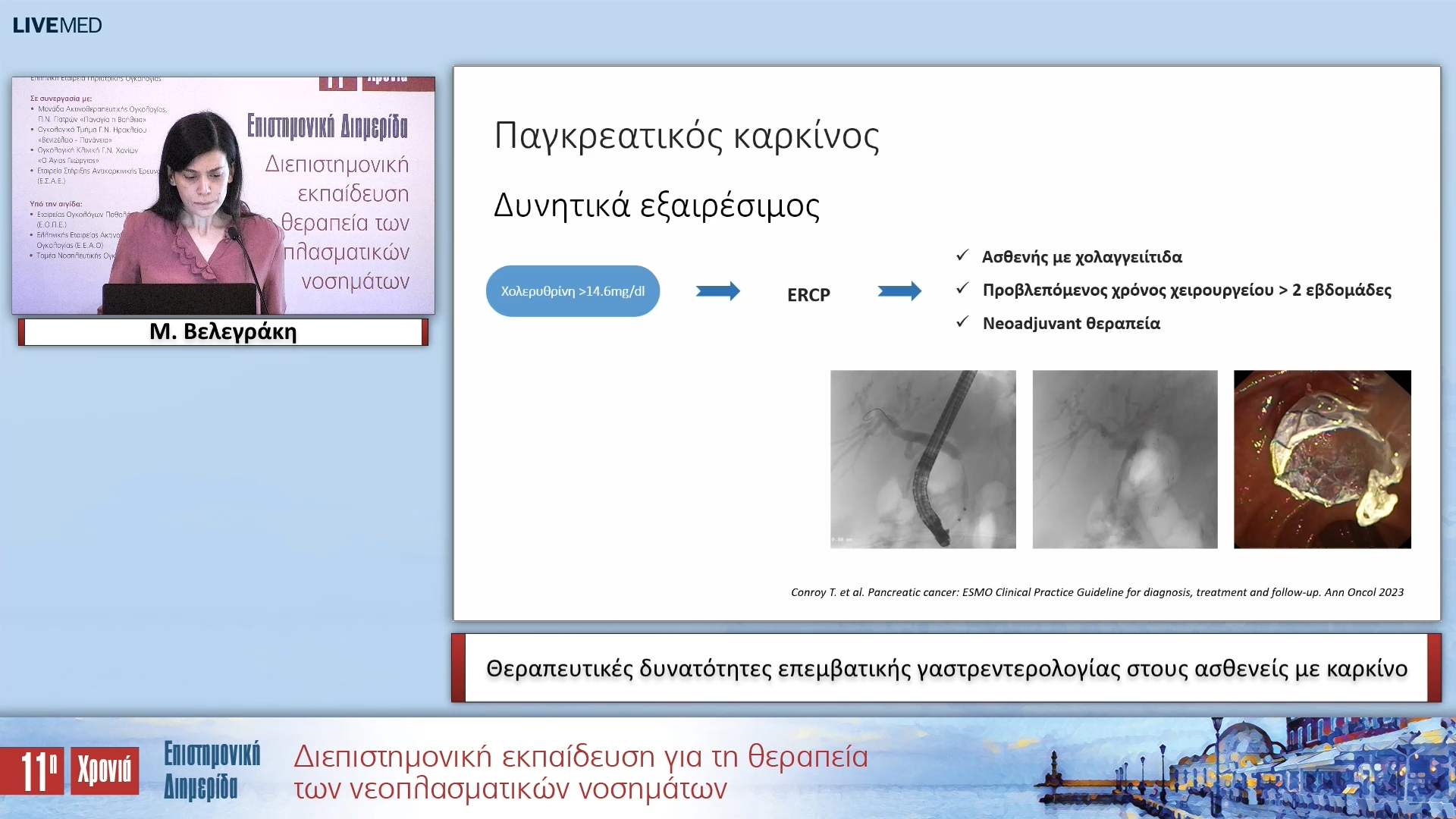 31 Μ. Βελεγράκη - Θεραπευτικές δυνατότητες επεμβατικής γαστρεντερολογίας στους ασθενείς με καρκίνο