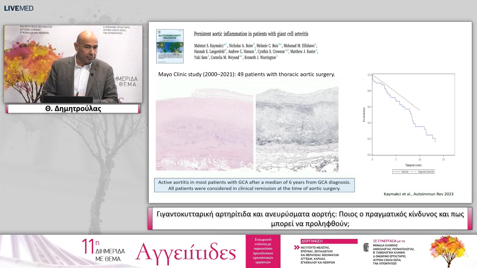 28 Θ. Δημητρούλας - Γιγαντοκυτταρική αρτηρίτιδα και ανευρύσματα αορτής: Ποιος ο πραγματικός κίνδυνος και πως μπορεί να προληφθούν; 