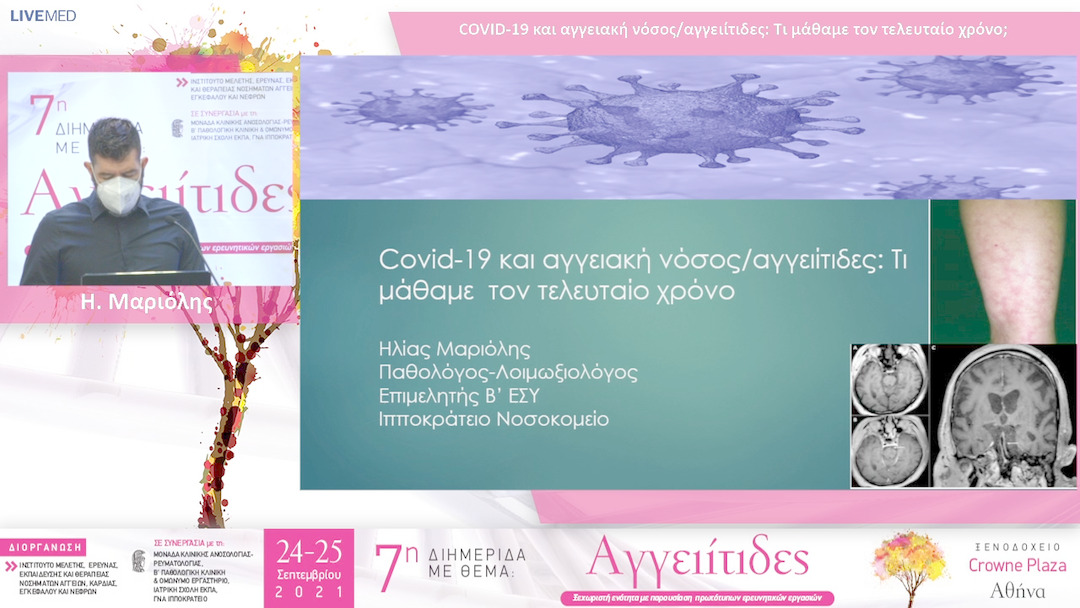 20 Η. Μαριόλης - COVID-19 και αγγειακή νόσος/αγγειίτιδες: Τι μάθαμε τον τελευταίο χρόνο; 