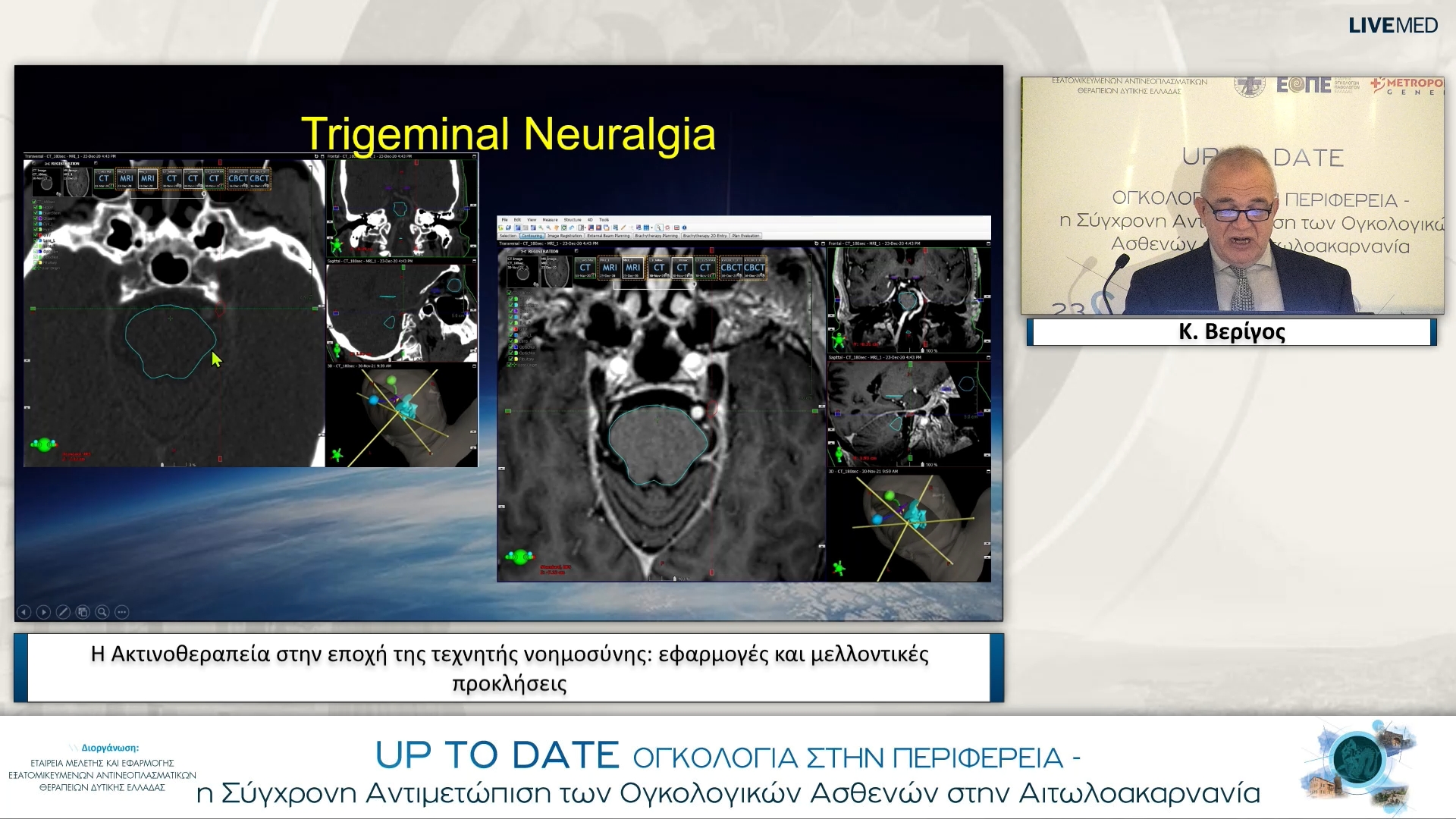 36 Κ. Βερίγος - Η Ακτινοθεραπεία στην εποχή της τεχνητής νοημοσύνης: εφαρμογές και μελλοντικές προκλήσεις