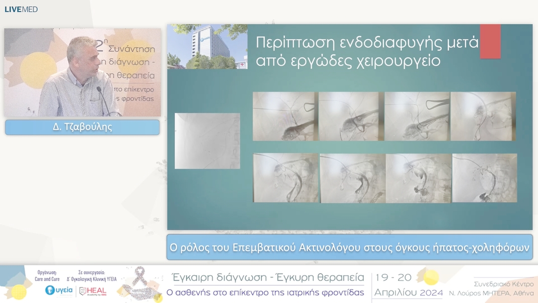 45 Δ. Τζαβούλης - Ο ρόλος του Επεμβατικού Ακτινολόγου στους όγκους ήπατος-χοληφόρων 