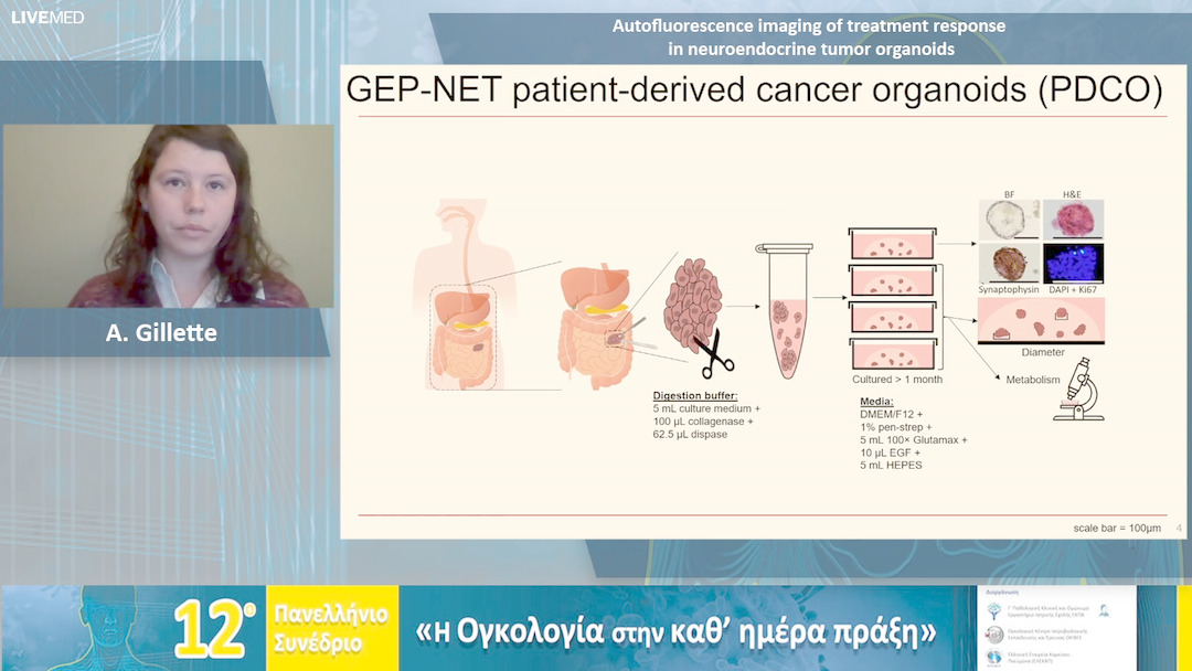 40 A. Gillette - Autofluorescence imaging of treatment response in neuroendocrine tumor organoids 