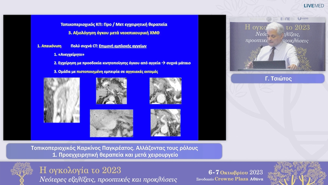 29  Γ. Τσιώτος -  Προεγχειρητική θεραπεία και μετά χειρουργείο 
