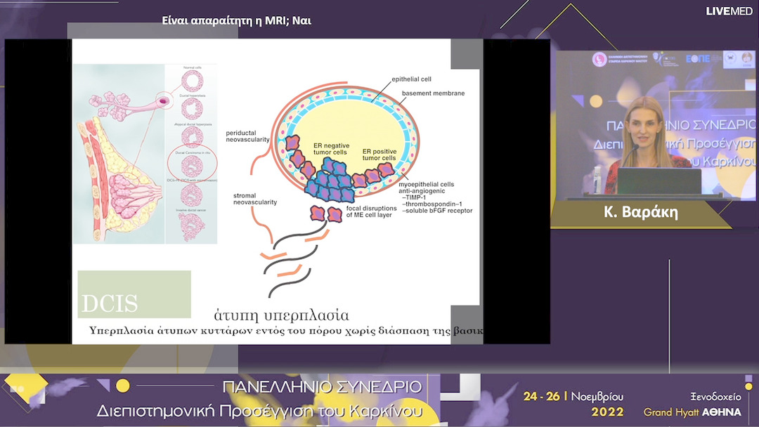43 Κ. Βαράκη - Είναι απαραίτητη η MRI; - Ναι