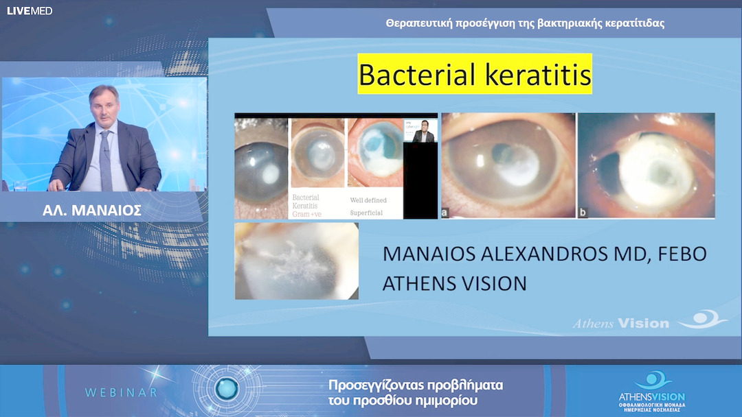02 ΑΛ. ΜΑΝΑΙΟΣ - Θεραπευτική προσέγγιση της βακτηριακής κερατίτιδας 