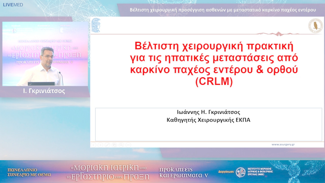 50 Ι. Γκρινιάτσος - Βέλτιστη χειρουργική προσέγγιση ασθενών με μεταστατικό καρκίνο παχέος εντέρου