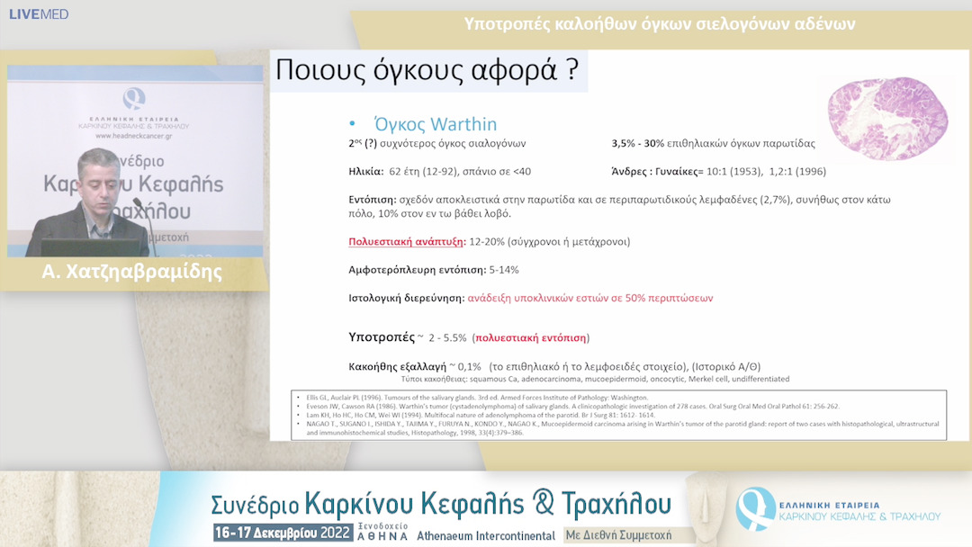 42 A. Χατζηαβραμίδης - Υποτροπές καλοήθων όγκων σιελογόνων αδένων.