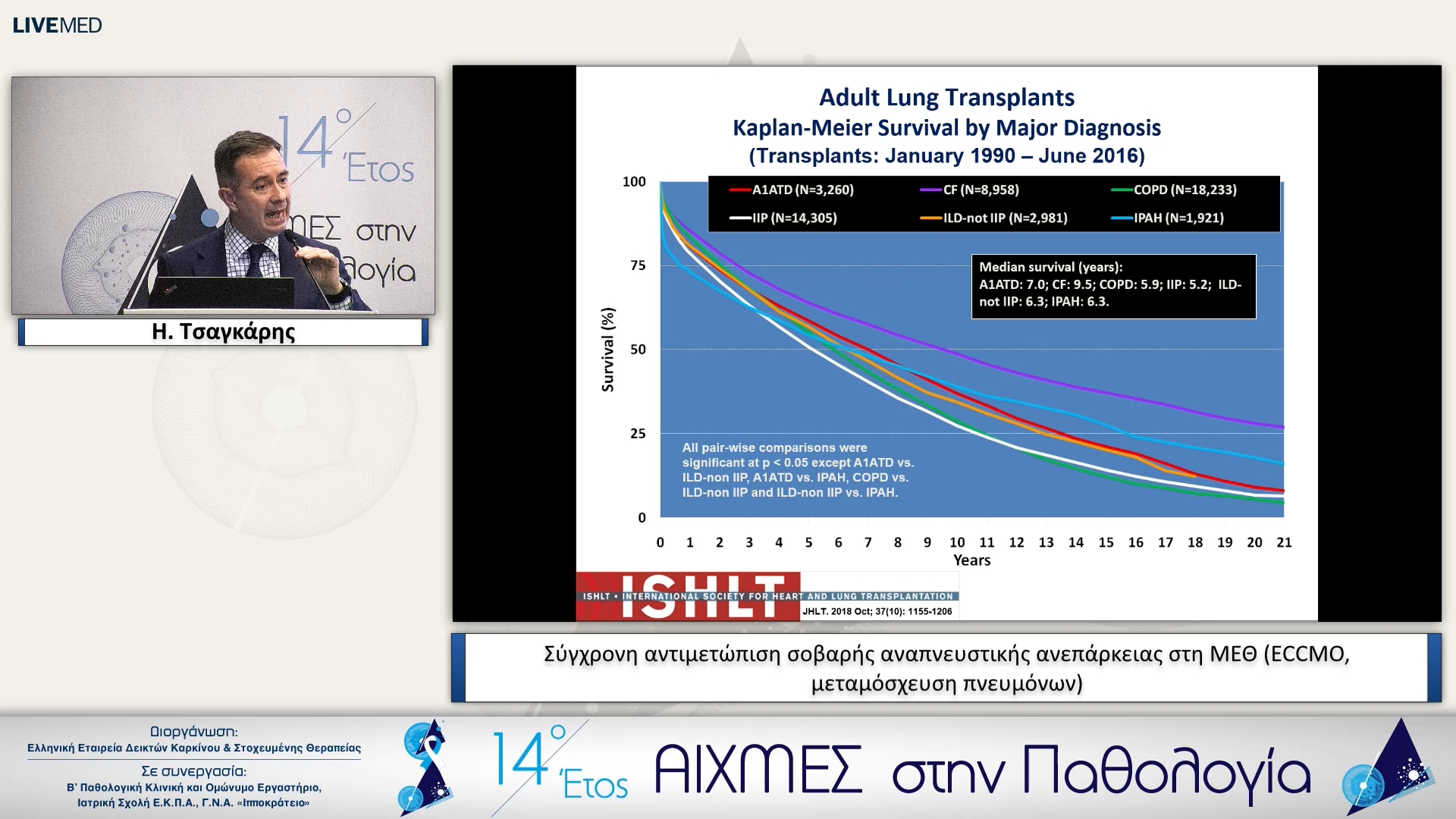 23 Η. Τσαγκάρης - Σύγχρονη αντιμετώπιση σοβαρής αναπνευστικής ανεπάρκειας στη ΜΕΘ (ECCMO, μεταμόσχευση πνευμόνων)