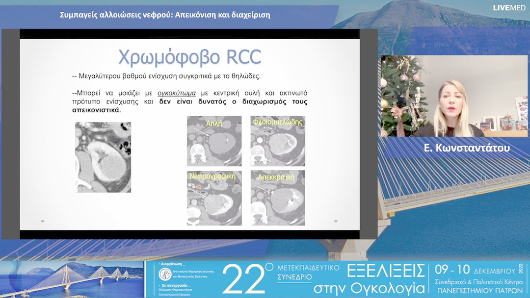 21 Ε. Κωνσταντάτου - Συμπαγείς αλλοιώσεις νεφρού: Απεικόνιση και διαχείριση 