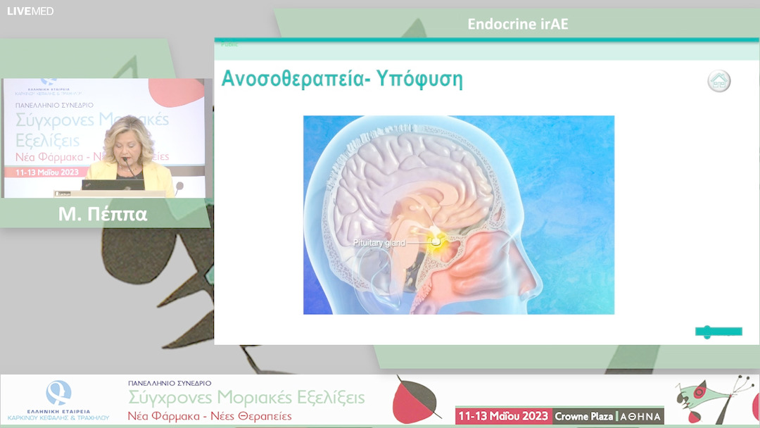 46 M. Πέππα - Endocrine irAE