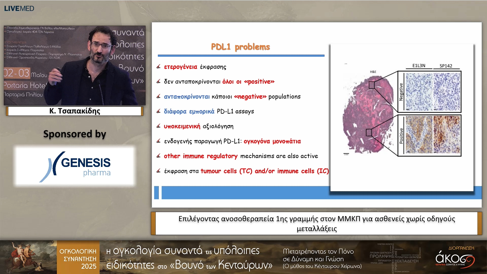 27 Κ. Τσαπακίδης  - Επιλέγοντας ανοσοθεραπεία 1ης γραμμής στον ΜΜΚΠ για ασθενείς χωρίς οδηγούς μεταλλάξεις