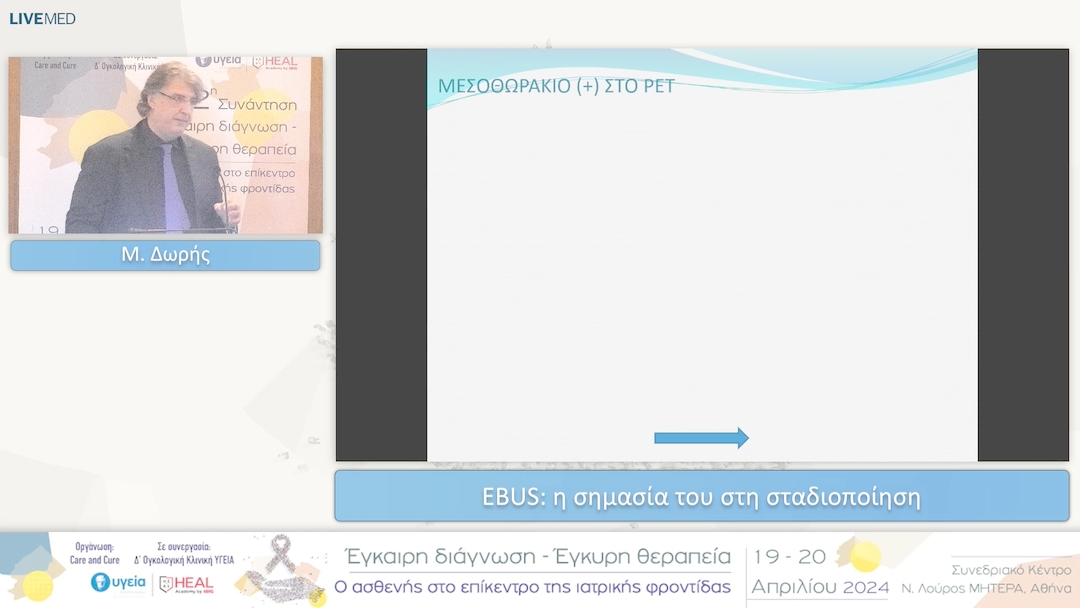 34 M. Δωρής - EBUS: η σημασία του στη σταδιοποίηση 