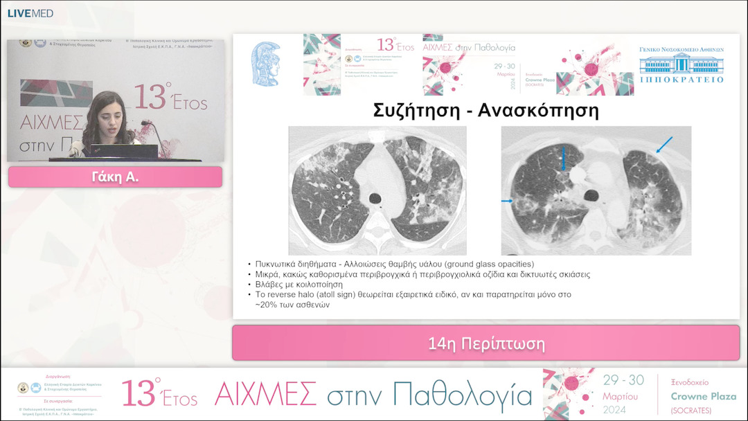 14 Γάκη Α. - 14η Περίπτωση.