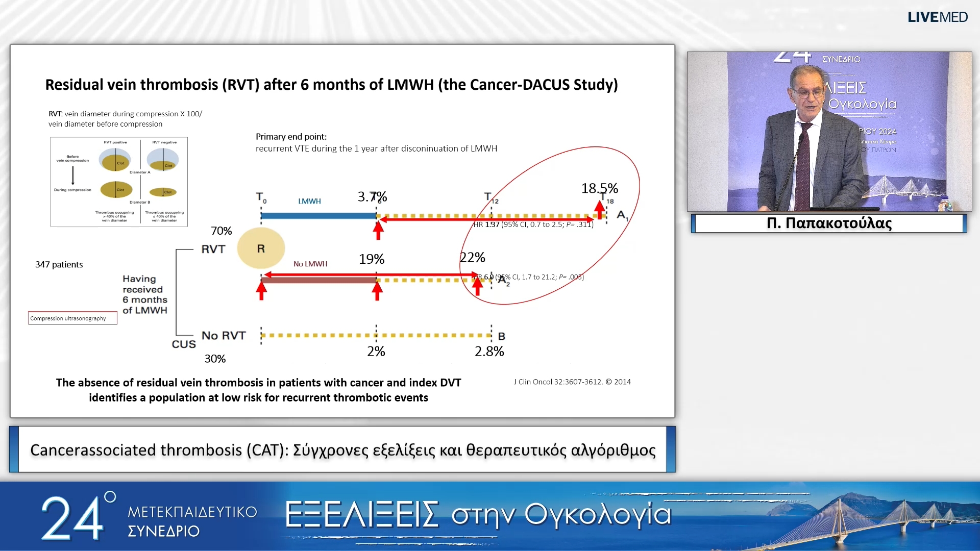 11 Π. Παπακoτούλας - Cancer­associated thrombosis (CAT): Σύγχρονες εξελίξεις και θεραπευτικός αλγόριθμος 
