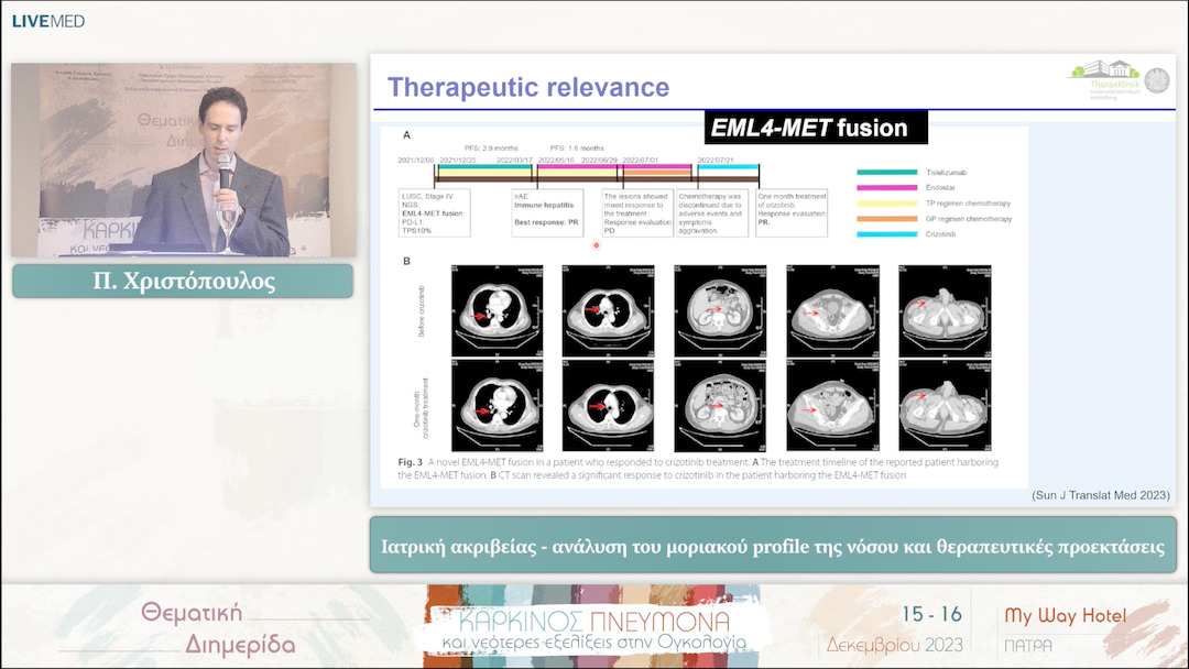 34 Π. Χριστόπουλος - Ιατρική ακριβείας - ανάλυση του μοριακού profile της νόσου και θεραπευτικές προεκτάσεις 