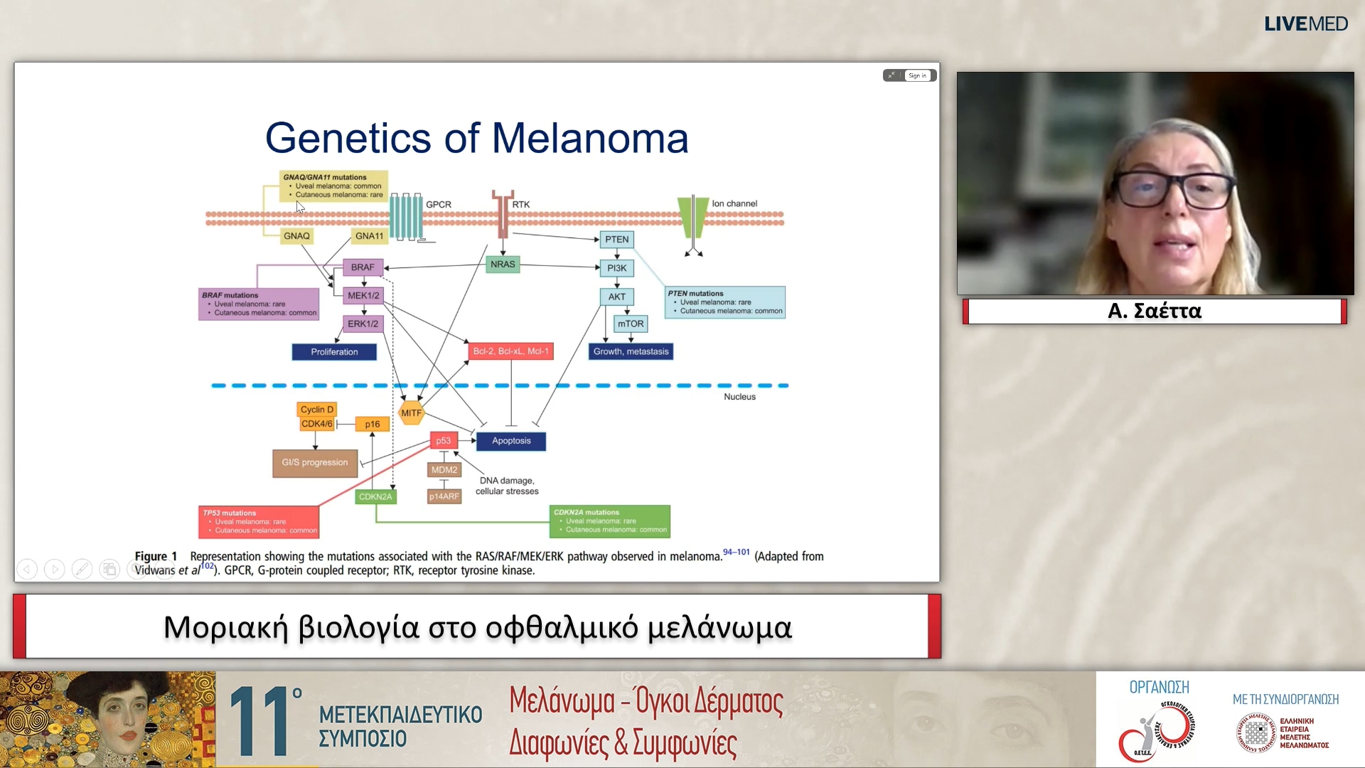 32 Α. Σαέττα - Μοριακή βιολογία στο οφθαλμικό μελάνωμα