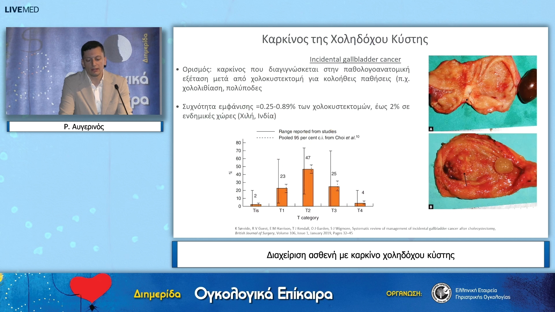 31 Ρ. Αυγερινός - Διαχείριση ασθενή με καρκίνο χοληδόχου κύστης