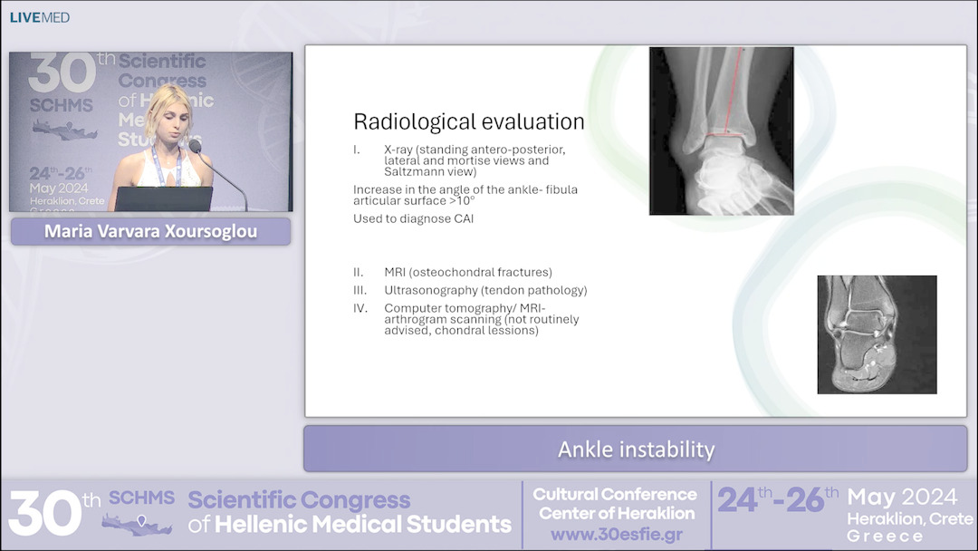 33 Maria Varvara Xoursoglou - Ankle instability